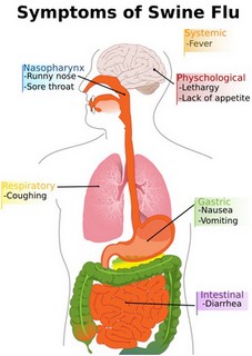 swine flu symptoms